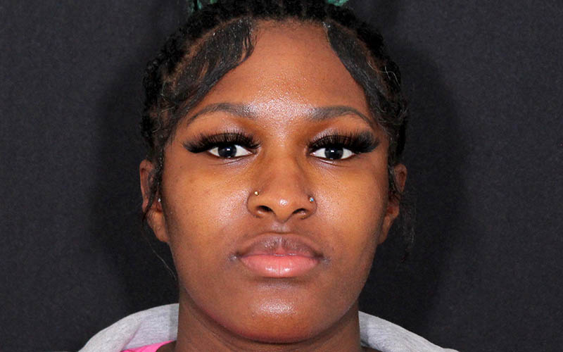 Otoplasty Before & After Image
